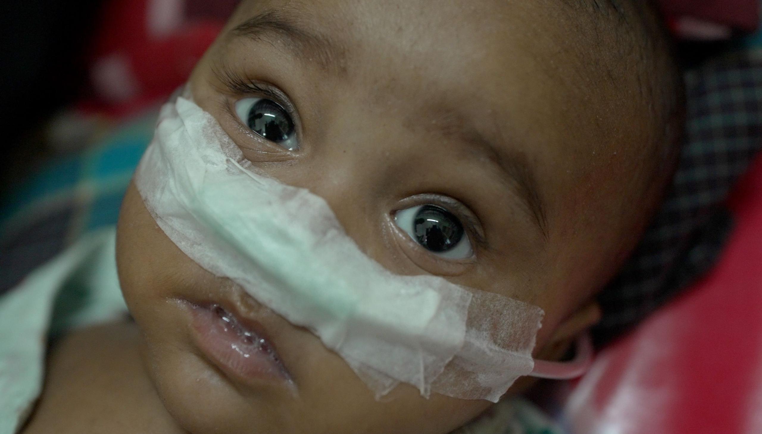 Measles outbreak in Bangladesh kills children, doctors say