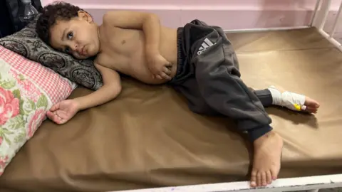Desperate Times: Gaza's Children Await Life-Saving Care Amidst Ceasefire
