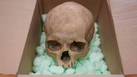 A Long-Awaited Return: Tourist Sends Back Skull Stolen from Vienna's Cathedral After 60 Years