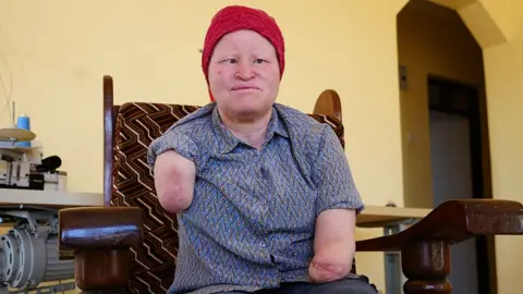 Surviving Terror: The Plight of People with Albinism in Tanzania During Elections